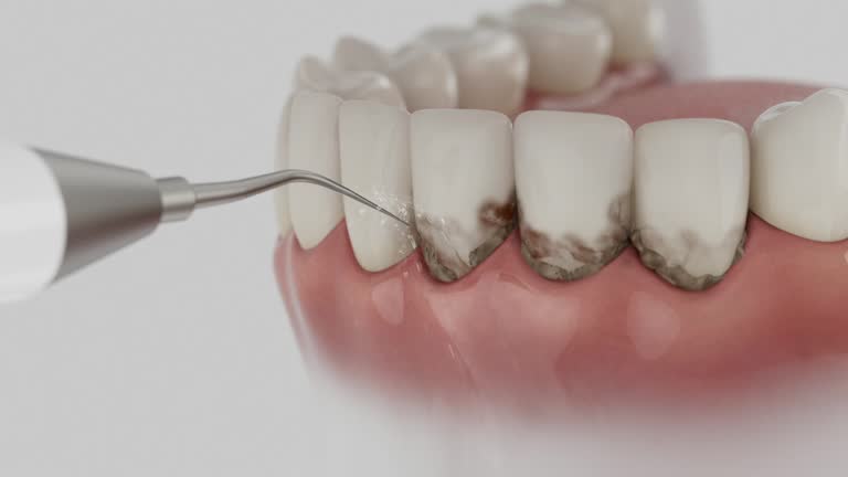 Trusted Root Canal Treatment service in Lake St. Louis, MO - Dentist Open Now
